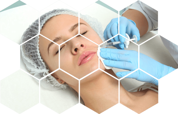 Ботулинотерапия