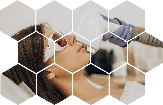 лазерная косметология