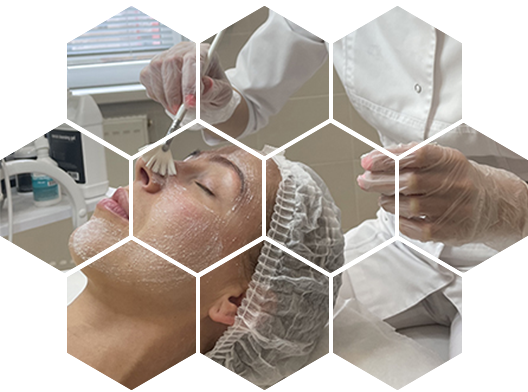 Механическая чистка кожи лица