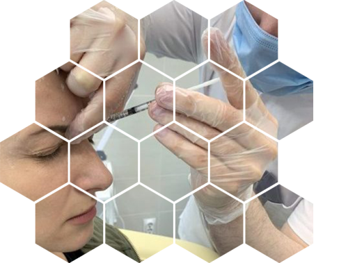 Ботулинотерапия