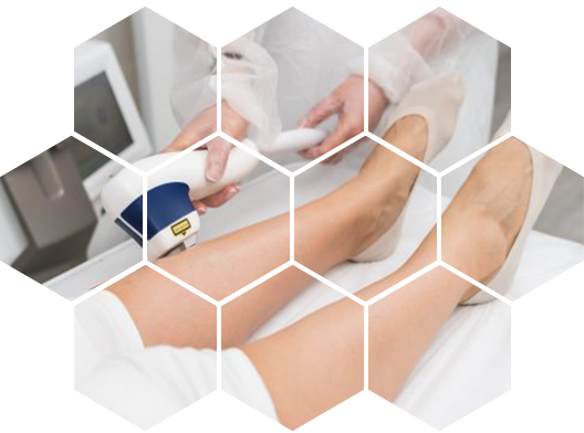 Диодная лазерная эпиляция Mediostar Next Pro