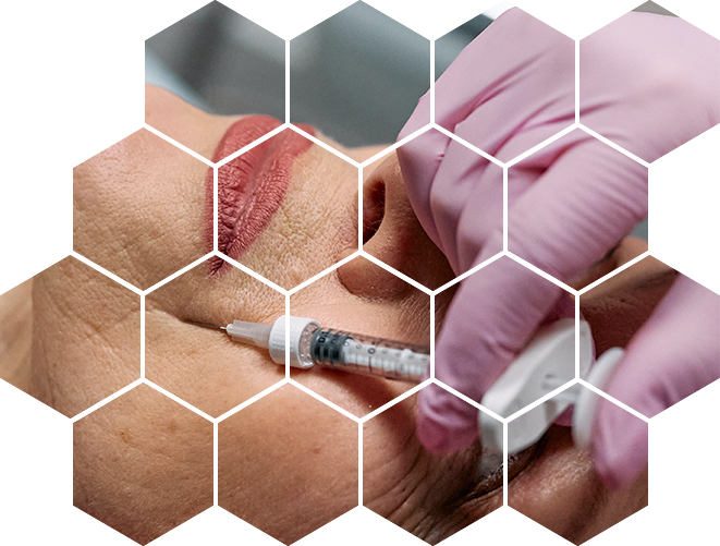 GAG Complex DVL Capyl