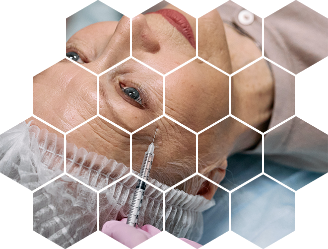 Лифтинг Nucleo Spire