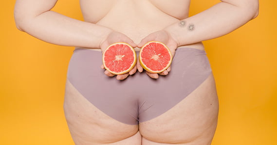 антицеллюлитный массаж