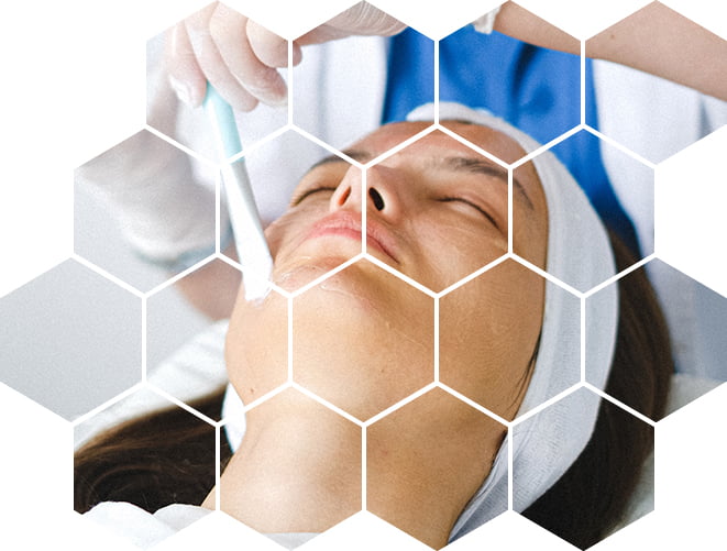 карбоновый пилинг