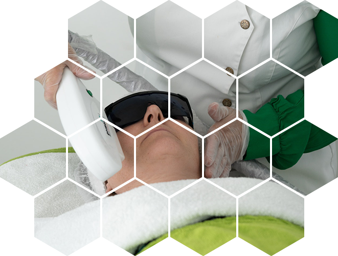 Фотоомоложение